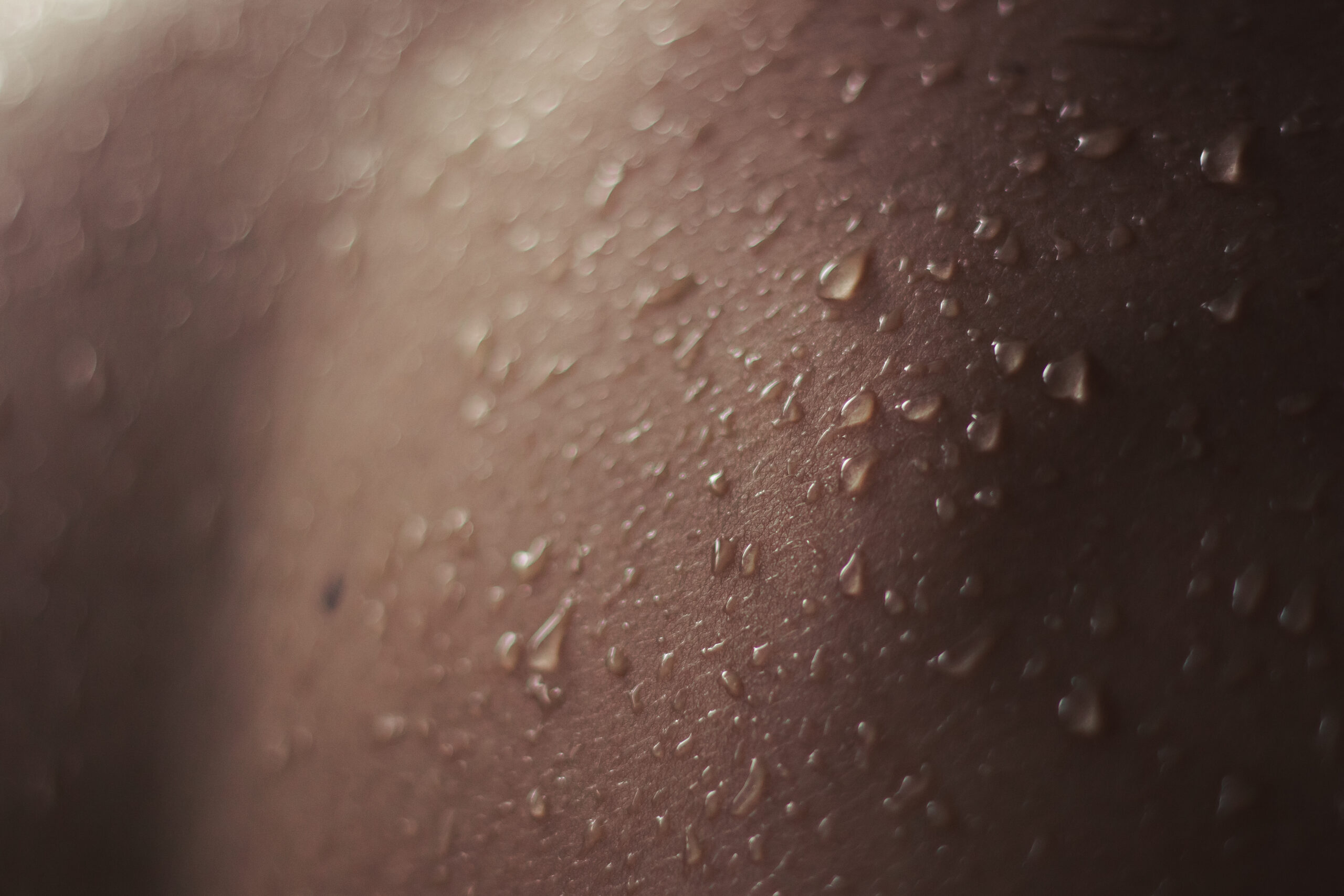 Close-up de pele humana com múltiplas gotas de suor visíveis na superfície, destacando suor excessivo associado à hiperidrose.